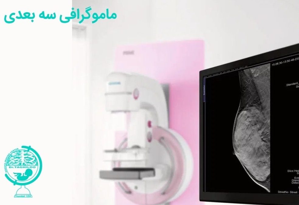 ماموگرافی سه بعدی چیست؟ بررسی مزایا و عوارض آن