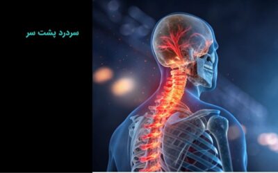 سردرد پشت سر: دلایل بروز، پیشگیری و درمان