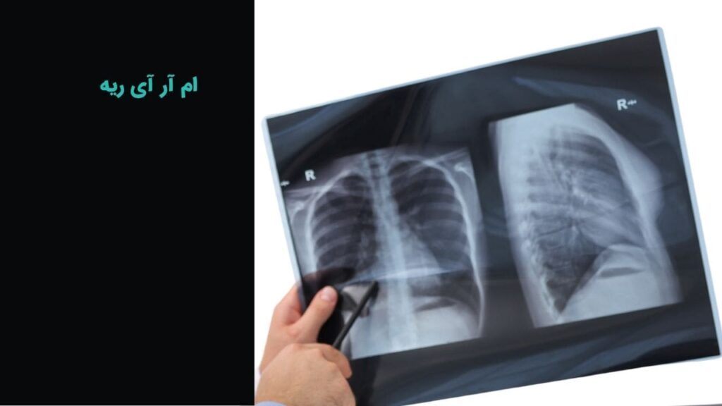 ام آر آی ریه