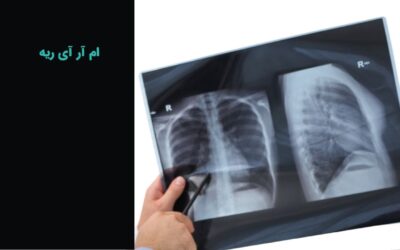 ام آر آی ریه و قفسه سینه و شش
