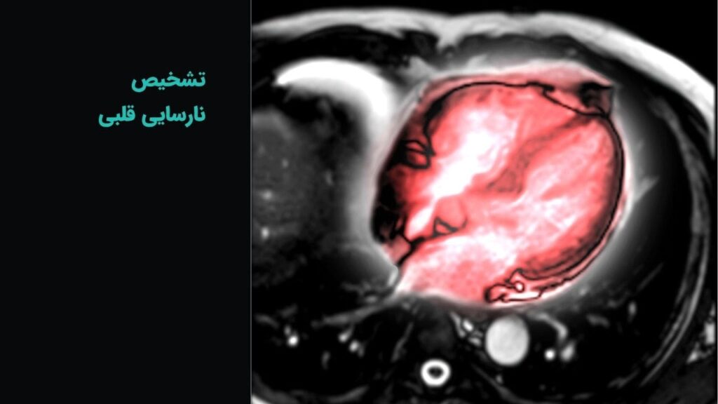 تشخیص نارسایی قلبی