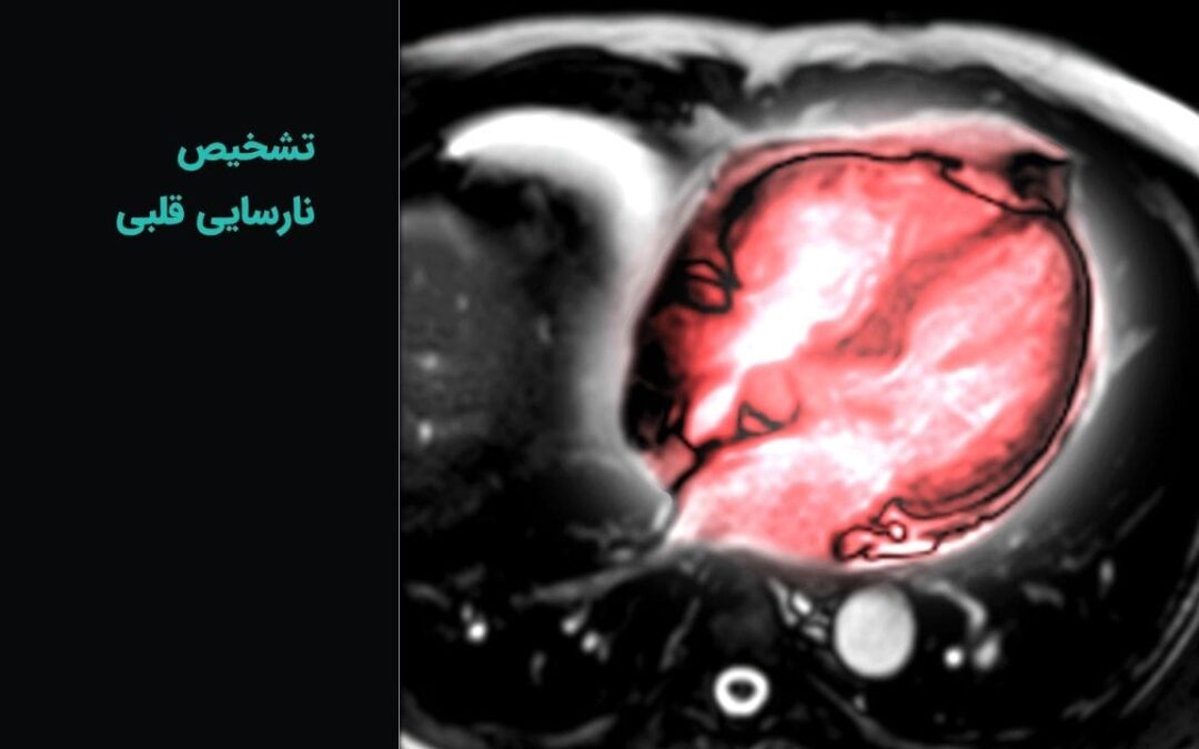 تشخیص نارسایی قلبی