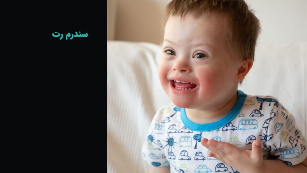 میکروسفالی