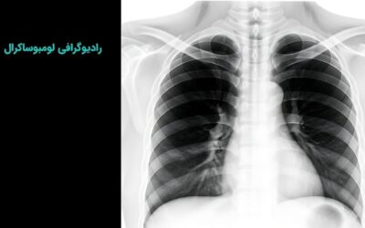 رادیوگرافی لومبوساکرال | کاربردها، نحوه انجام و آمادگی لازم