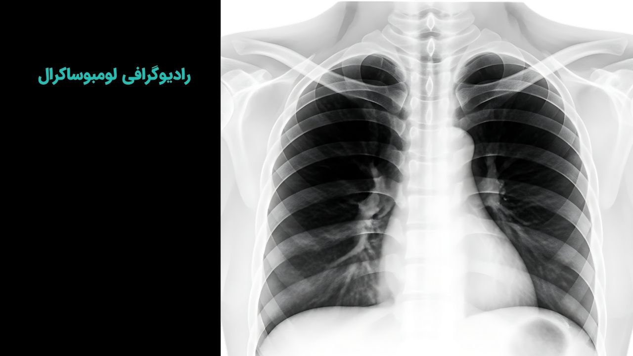 اختلال خواب شیفت کاری اختلال خواب شیفت کاری