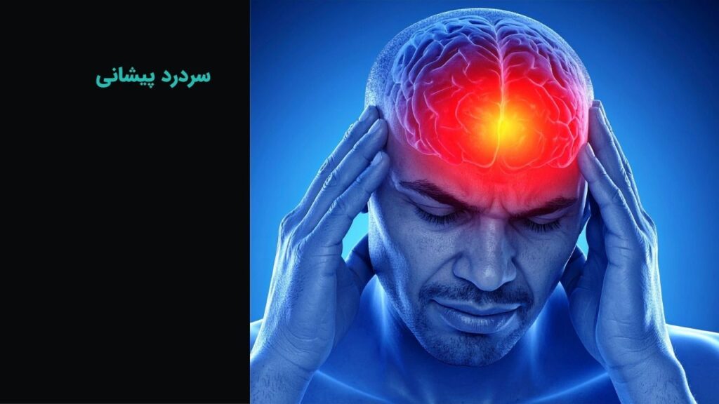 سردرد پیشانی