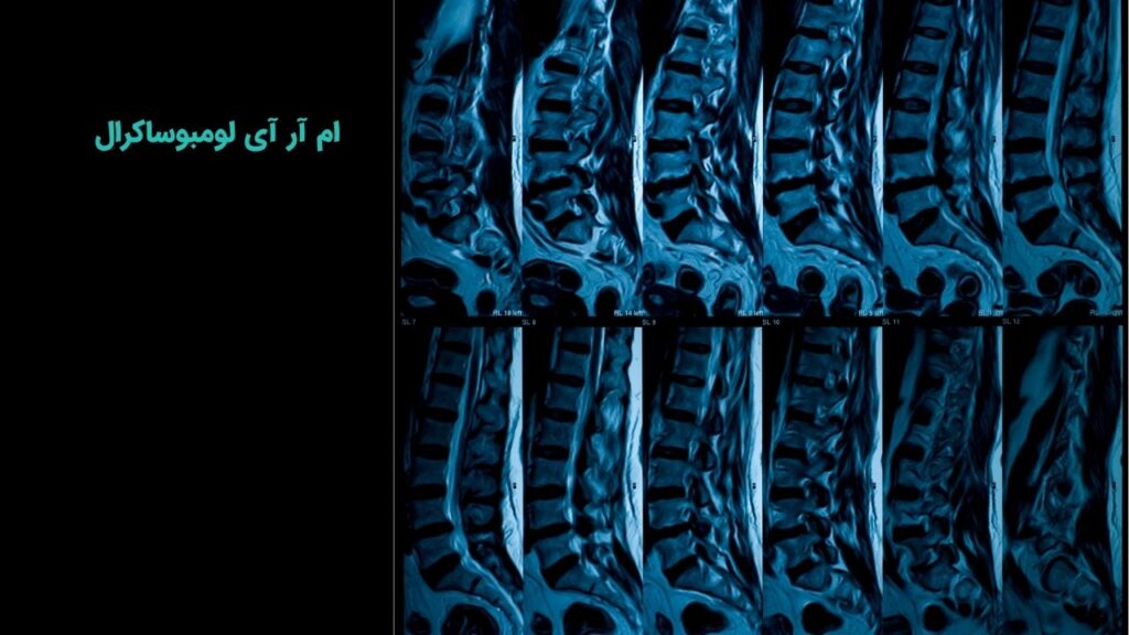 ام آر آی لومبوساکرال