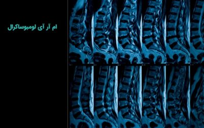 ام آر آی لومبوساکرال چیست و چگونه انجام میشود؟