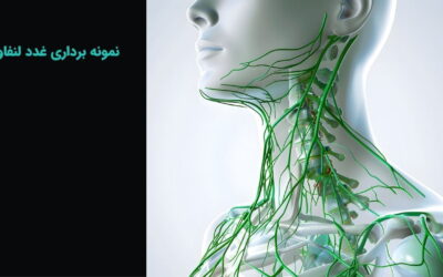 بیوپسی یا نمونه برداری غدد لنفاوی