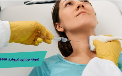 نمونه برداری تیروئید FNA