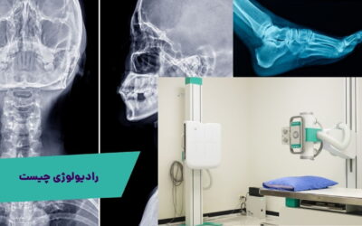 رادیولوژی چیست؟، انواع، کاربرد و عوارض