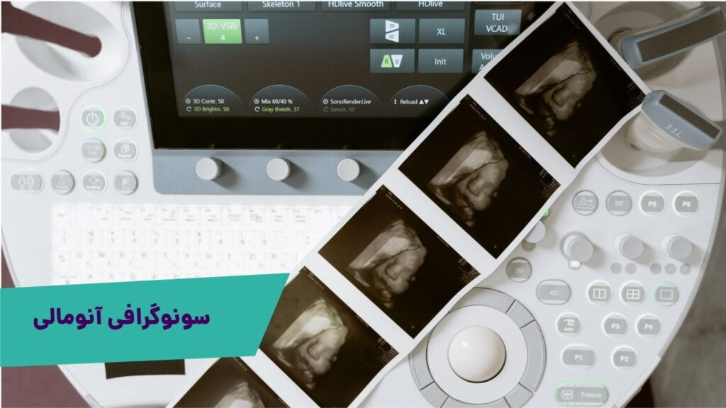 سونوگرافی آنومالی